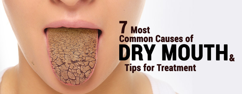 7 Most Common Causes Of Dry Mouth Tips For  